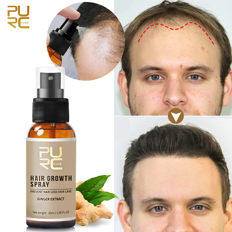 Licorice Root Sticks - PURC Ginger Hair Growth Spray Anti